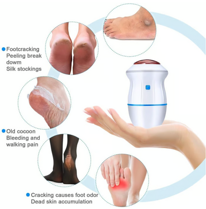 🔥HOT-SALE🔥 New Electric Foot Grinder Skin Hard Rupture Skin Trimmer Dead Skin
