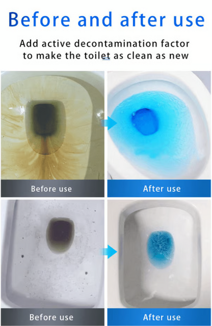 HOT SALE 49% OFF💕SINK & DRAIN CLEANER🔥Buy More Save More